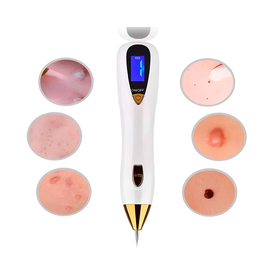 MOLE PEN - Imagen 2